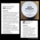 Hand and Body Lotion, Intense Dry Skin Therapy Cream, Goats Milk,  No.9 Skin Therapy